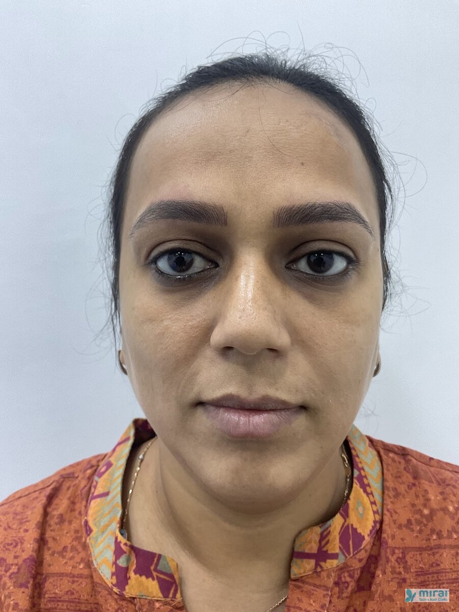 Ami Shah - Before After Microblading