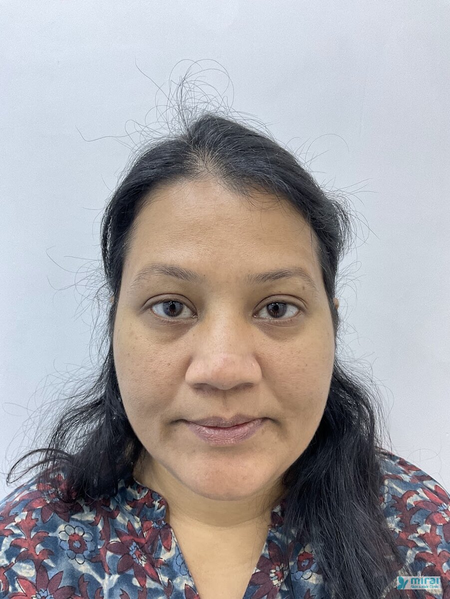 Divya - Before After Microblading