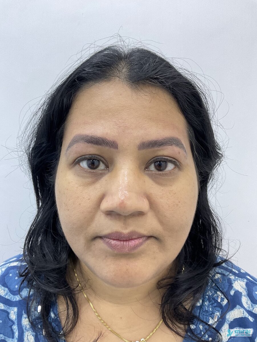 Divya - Before After Microblading