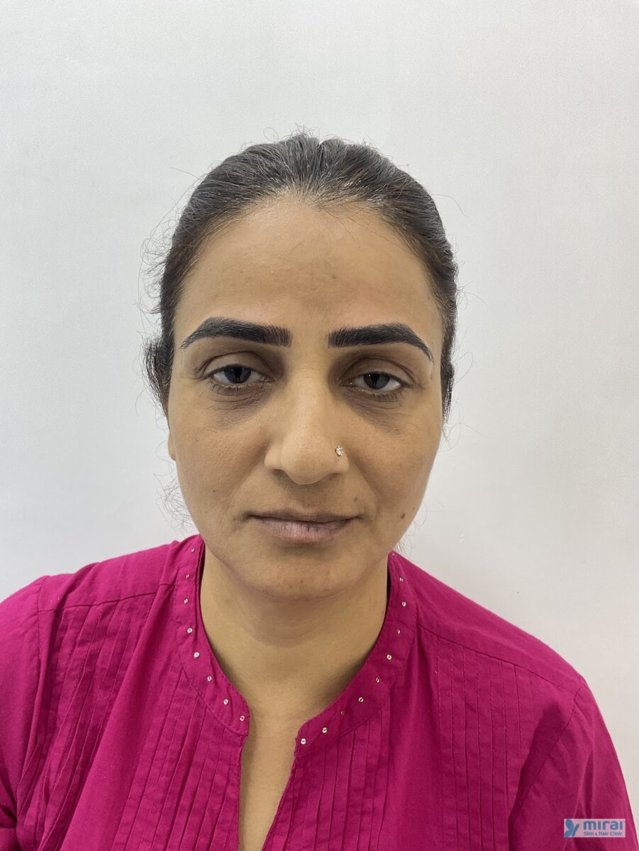 Priti Chauhan - Before After Microblading