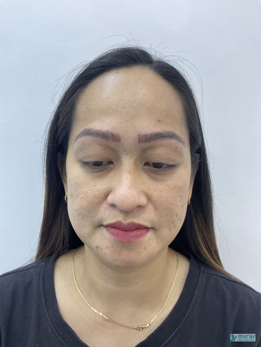 Rinalyn - Before After Microblading