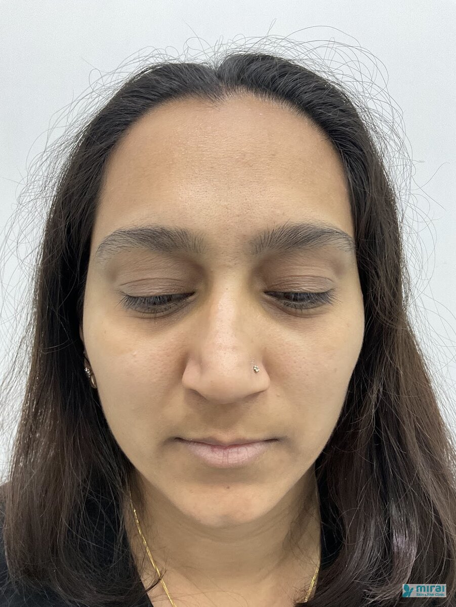 Tanvi - Before After Microblading