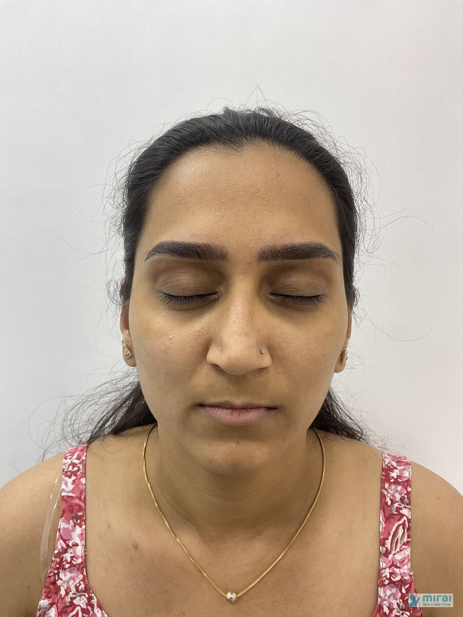 Tanvi - Before After Microblading