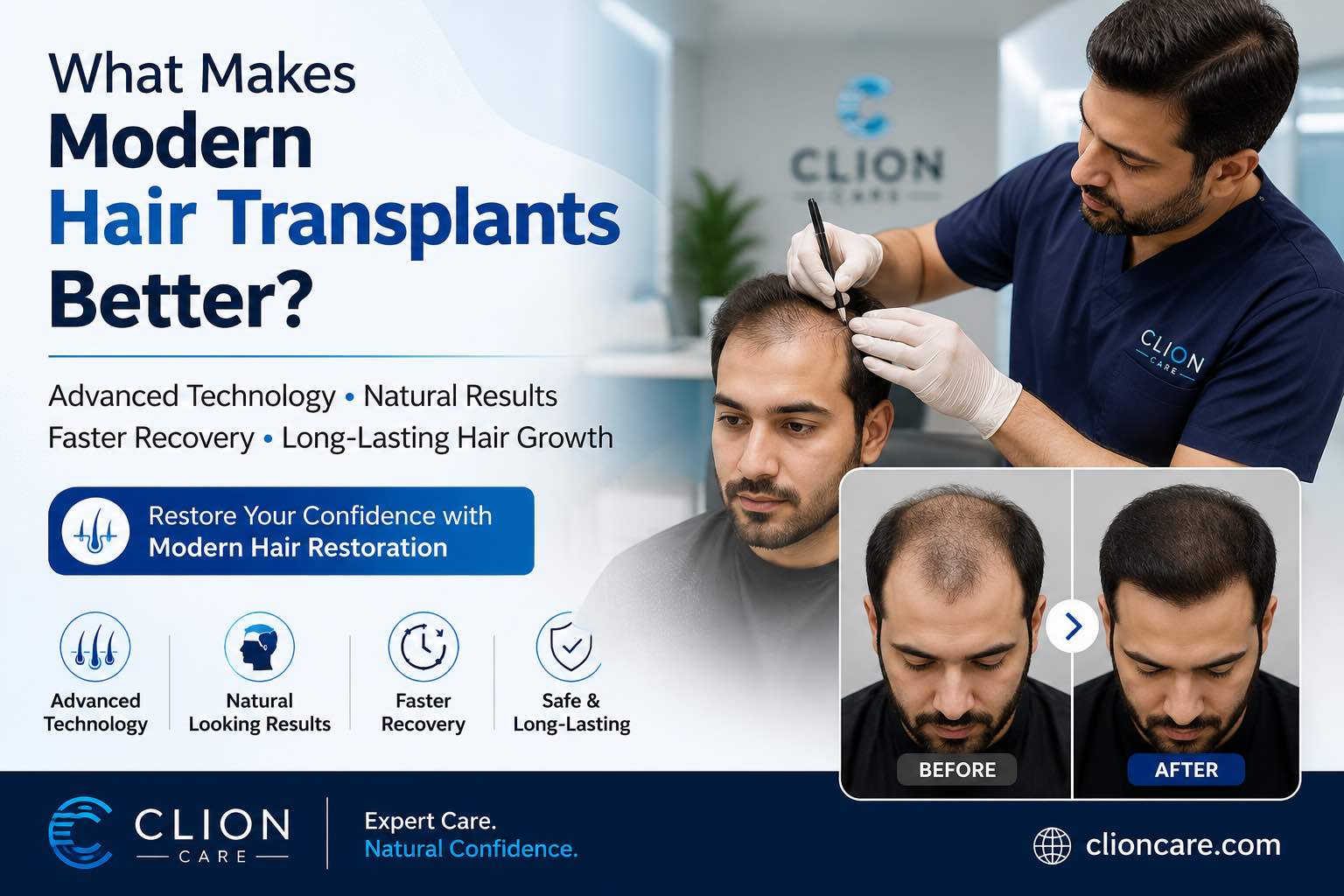 What Makes Modern Hair Transplants Better?